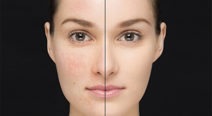 پرایمر چیست و چرا باید از آن استفاده کرد؟