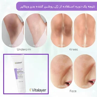 ژل روشن کننده نواحی حساس بادی ویت ویتالیر حجم 150 میلی لیتر